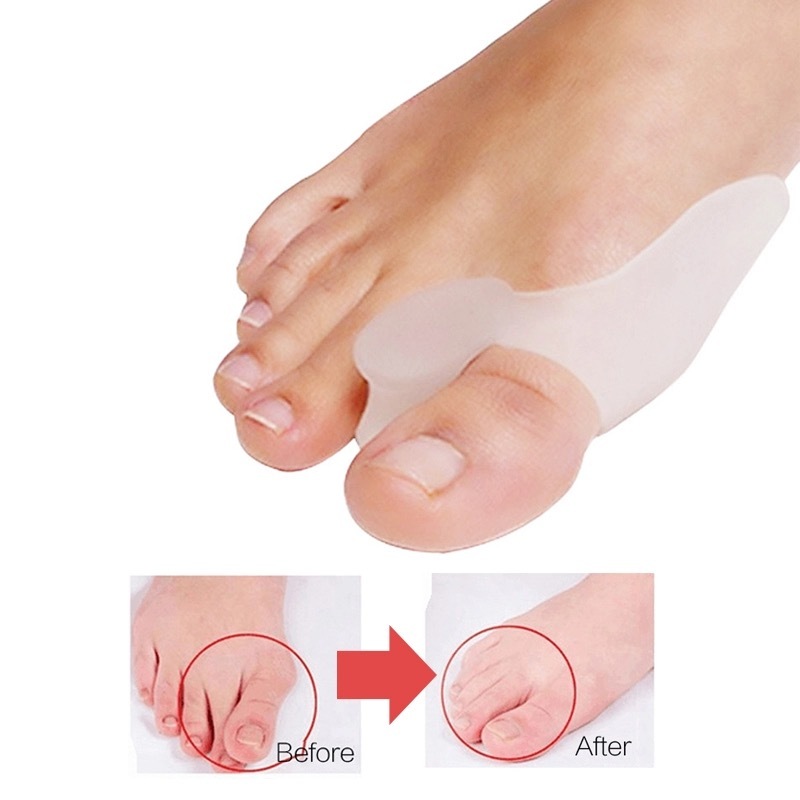 

Силиконовый фиксатор большого пальца Toe Shreader 1 пара