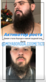 КУРС восстановления и роста бороды/волос